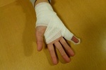 201302_キキの骨折.jpg